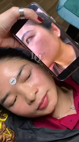 Cập nhật da Sạm #chamsocdamun#chamsocdaseo#chamsocdanam#tanbinh#Lqspa&academy