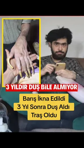 Hatay’da Depremden Sonra 3 Yıl Evden Çıkmayan Genç Zorla Tıraş Ettirildi Hatay’da 6 Şubat depreminin ardından içine kapanan 23 yaşındaki Barış Özbay, yaklaşık 3 yıl boyunca evden çıkmadı, tıraş olmadı ve kişisel bakımını yapmadı. Yaşadığı travma nedeniyle sosyal hayattan tamamen kopan genç, Aile ve Sosyal Hizmetler Müdürlüğü ekiplerinin uzun süren ikna çabaları sonucu evden çıkarıldı. Deprem sonrası yaşama hevesini kaybeden Barış Özbay, üniversitesini yarıda bıraktı ve neredeyse tüm zamanını telefon ve bilgisayar başında geçirdi. Komşuların ve yakınlarının ihbarı üzerine durum Hatay Valiliği’ne bildirildi. Valilik talimatıyla Aile ve Sosyal Hizmetler Müdürlüğü ekipleri harekete geçti. Ekipler, saatler süren ikna çalışmasının ardından genci Engelli Yaşam Merkezi’ne götürdü. Burada Özbay’a tıraş yaptırıldı, duş aldırıldı ve sağlık kontrolünden geçirildi. Üç yıl sonra ilk kez temizlenen ve tıraş olan Barış Özbay, yaşadığı süreci şöyle anlattı: > “Biraz direnç gösterdim ama zorla beni kaldırıp götürdüler. Saç ve sakal tıraşı oldum, banyo yaptım. Yenilikler mutlu ediyor ama bir şey yapmak istemiyorum.” Aile ve Sosyal Hizmetler İl Müdürlüğü yetkilileri, Barış Özbay’ın durumunun yakından takip edileceğini, evinin temizleneceğini ve psikososyal destek hizmetlerinin devam edeceğini açıkladı.