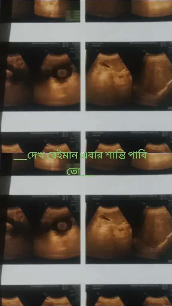 #টাকা #foryou #vairal #tiktok #bangladesh 