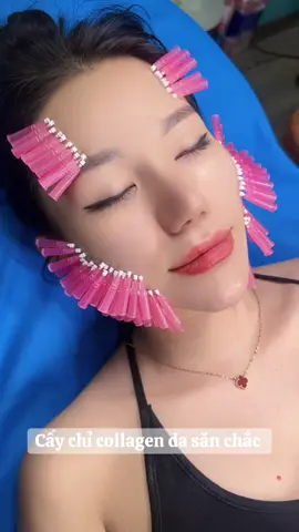 #caychicollagen #dasanchac#triseoro#lochanlong #lusia 