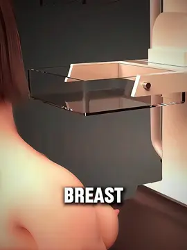 Ever Wondered How Mammography Detects Breast Cancer Early? #mammography #BreastCancerAwareness #earlydetection #womenshealth #medicalanimation 