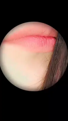 @.🫀🥀🫀🥀. #unfrezz #