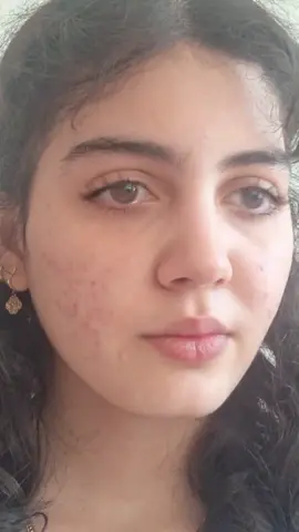 Sa khalak mang da zansara adat ke 💔🥹#Repost #foryou #foryoupage #viralvideo #trending 🥺🥺🫀