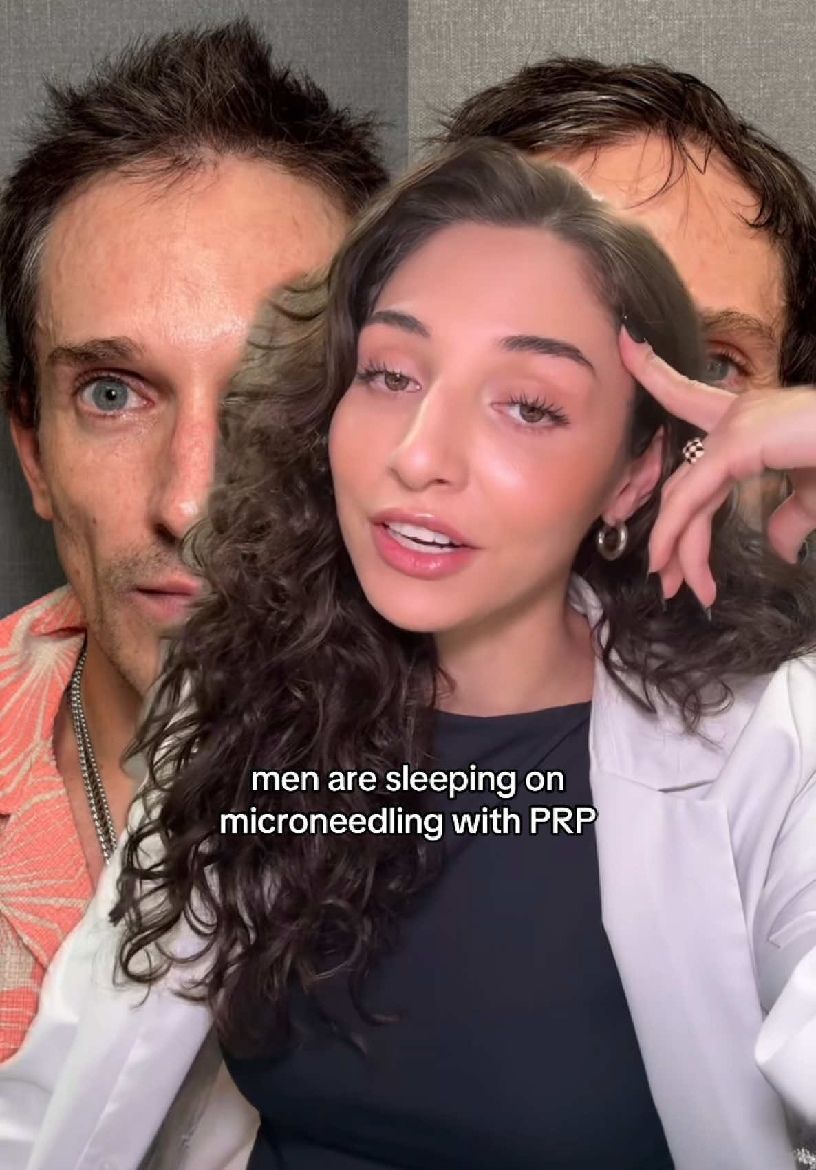 Men are sleeping on microneedling with PRP 👀💉 It’s not just for women — it helps with acne scars, texture, pores & collagen. Real results, no filter needed!  🗓️ Love your look—Book your appointment today at LookLab.com or call 833.999.5665 (LOOK) #Microneedling #Collagen #PRP #MedSpa 