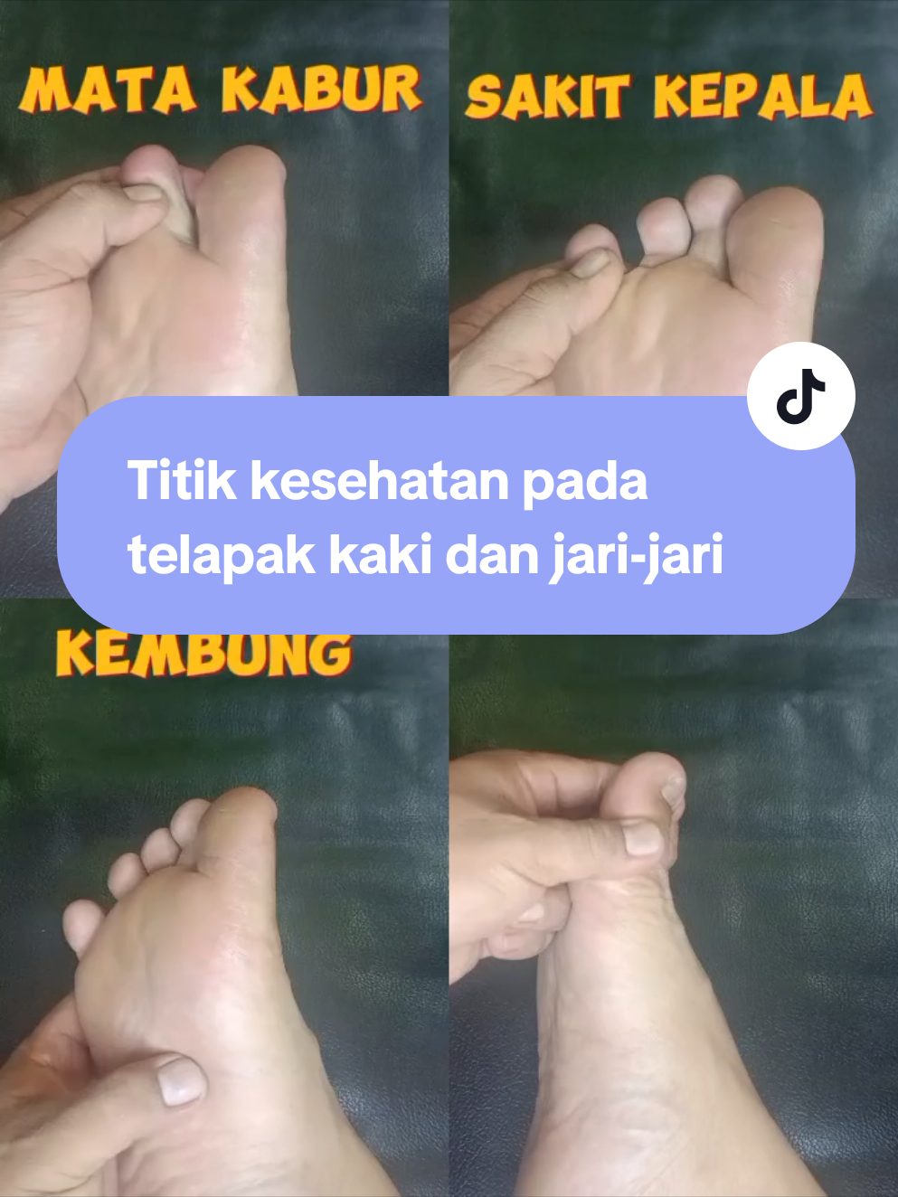 Teknik kesehatan pada kaki dan jari2 terhubung ke organ tubuh  #sehat #alami #pijatindonesia 