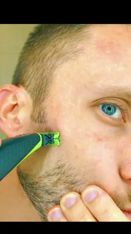 The Smoothest Shaver EVER? Even with ACNE! 
