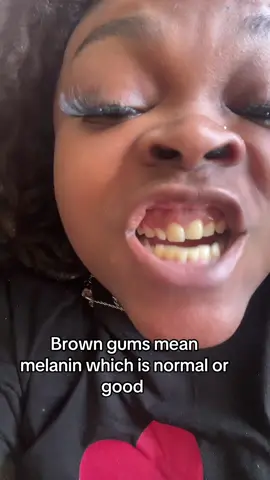 Just be doing anything on this dang app lol #funny #melaningums #teethcheck #fyp 