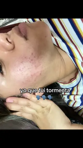 todo es un proceso, lidiar con las inseguridades q te causa el acné es horrible, llorar porque no ves cambios, hacer mil cosas y qué nada funcione pero después de la tormenta llega la calma.❤️‍🩹 aún no es un resultado final, pero gracias a dios eh mejorado bastante. no todo es aplicarte mil productos, si no tmb tener disciplina y cambiar tus hábitos y tu entorno que tmb las malas energías existen.#pielsana #acneskincare #aceptacion #fryyyyyyyyyyy #paratiiiiiiiiiiiiiiiiiiiiiiiiiiiiiii 