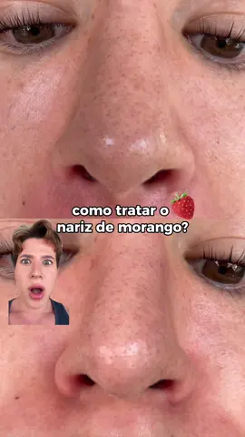 🏷️ Cupons ativos: • PRIMEIRAMIGUEL = 15% OFF + frete grátis (1ª compra) • MIGUEL = 10% OFF + frete grátis (acima de R$180) 🚨 LANÇAMENTO CREAMY! 🚨 Chegou o novo Limpador Facial Antioleosidade, com 2% de Ácido Salicílico, Ácido Mandélico e Prebióticos — um combo poderoso pra quem busca controle de oleosidade, poros mais limpos e pele equilibrada, sem ressecar 💧✨ 💡 Dica de rotina (Duo Limpador Antioleosidade + Duo Protetor Solar + Calming Cream) : 👉 De manhã e à noite, use o Limpador Antioleosidade + Solução Ácido Salicílico (3-4 gotinhas), para reduzir a oleosidade e prevenir cravos e acne, comece usando 2-3 x na semana. 👉 Após use o Calming Cream, que protege e acalma a pele, deixando o toque sequinho e confortável e de manhã aplique o Protetor Solar. 🕒 Modo de uso: 1️⃣ Aplique o limpador sobre o rosto úmido, massageie até formar espuma e enxágue. 2️⃣ Em seguida, use o Ácido Salicílico (à noite) ou vá direto para o protetor e o Calming Cream (de manhã). #CreamySkincare #SkincareComMiguel #MIGS #advogadodabeleza #CuidadosComAPele     