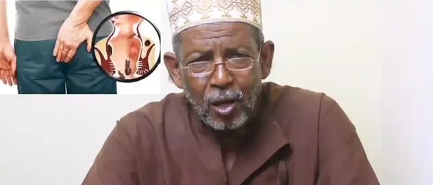 ujue ugonjwa wa bawasiri na tiba zake