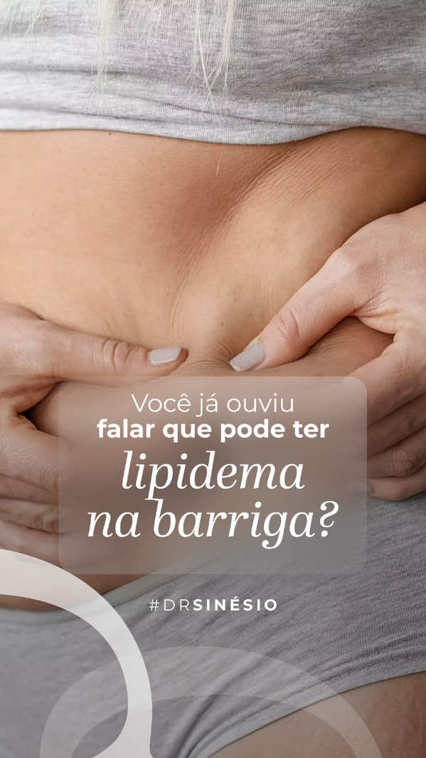 Você sabia que o lipedema também pode afetar a barriga? Muitas pessoas associam essa condição apenas às pernas, mas o acúmulo de gordura dolorosa pode sim se manifestar no abdômen! 🔍 Fique atento aos sinais: dor, sensibilidade ao toque, inchaço e gordura que não diminui mesmo com dieta e exercício. 🩺 Diagnóstico correto é essencial para o tratamento adequado! #Lipedema #LipedemaNaBarriga #SaúdeDaMulher #CorpoComDor #LipedemaNãoÉGordura    