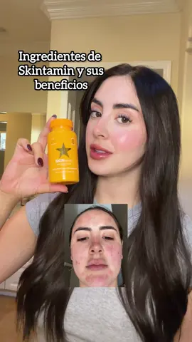 Skintamin en Amazon 💛 #acne #mexico #hormonas #resveratrol #granosenlacara 