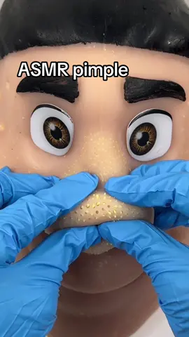 How long it will take me to clean his face ?? #Satisfying #PimplePopper #pimpletoy #ASMR #OddlySatisfying 