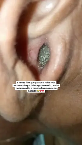 💔😭😭 #mae #hospital #filha #ouvido #filhos 