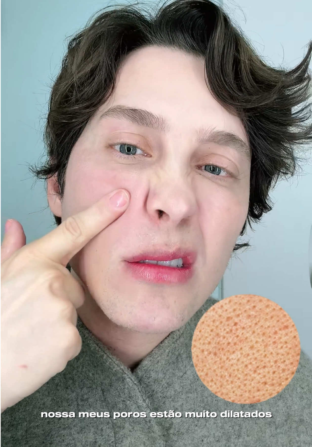 CUPO M: JARDEL no s ite da Principia A niacinamida é um dos ativos mais completos e versáteis no skincare. Ela atua como reguladora celular, ajudando a controlar a produção de oleosidade, reduzindo a aparência de poros dilatados e prevenindo o surgimento da acne. Além disso, melhora a uniformidade da pele, suavizando manchas causadas tanto pela inflamação da acne quanto pela exposição solar. Por ser multifuncional, pode ser incorporada em diferentes rotinas, seja para quem busca reduzir a oleosidade, tratar acne, clarear manchas ou apenas melhorar a textura e luminosidade da pele. Uma ótima opção é a Niacinamida 10% da Principia Skincare, que possui alta concentração, fórmula estável e acessível, garantindo eficácia comprovada para resultados visíveis no dia a dia. #principia #niacinamida #peleoleosa #porosdilatados 