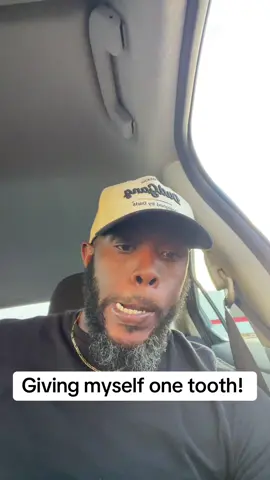 That laugh tho! 😂😂 #onetooth #onetoothchallenge 