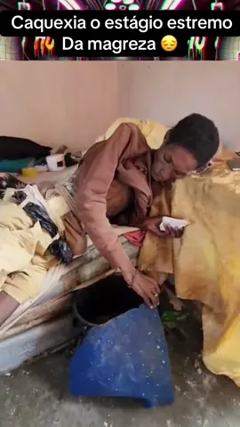 Caquexia 😔🧑‍⚕️ #morte #doenca #colostomia #medico #hospital 