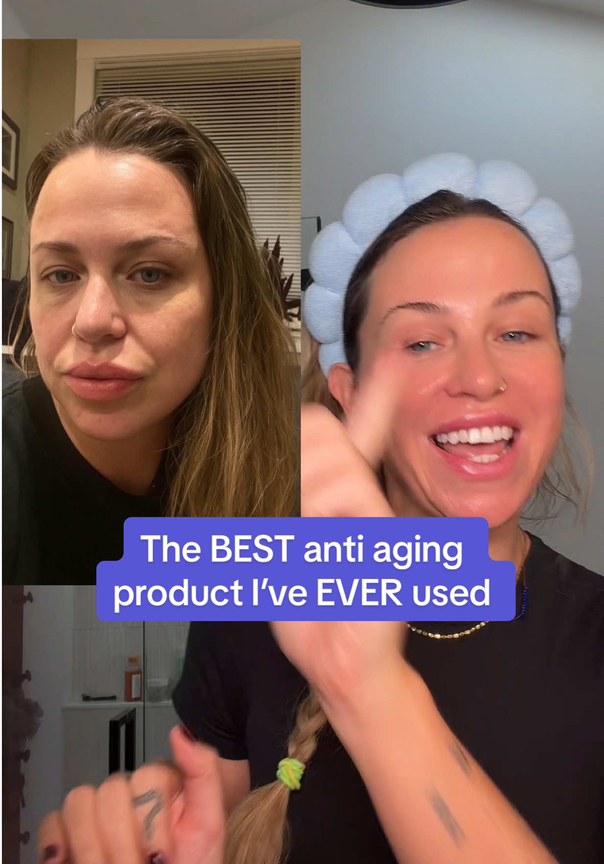 And it’s exclusive to TTS #antiaging #antiagingskincare #womenover30 #growthfactors #drmtlgy @DRMTLGY 