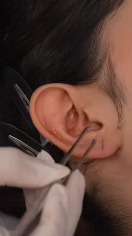 ASMR Ear Cleaning: Jelly Mask, Foam & Warm Oil | Gentle Care, Soft Treatment & Deep Relaxation #asmrrealperson #earclean #jellymask #asmrrelax #asmr #relaxing #ivybasmr #asmrtok #eartok #relaxtok