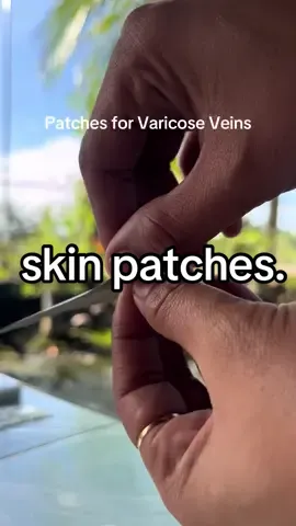 Varicose veins? Worry no more! Try this patches now. 💕💕✨ #varicoseveins #patchesforvaricose 