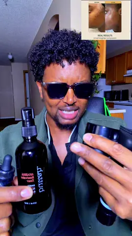 Buttah Skin Dark Spot Correcting skincare bundle #somalitiktok #shuayb_jhurtiktokshop #somaliminnesota #somaliamerica 