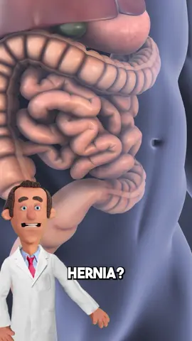 What is a hernia? follow Dr. Pickle for MORE ‼️ #doctor #health #explore