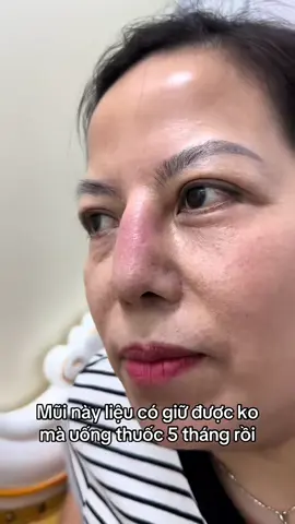 #nangmui #xuhuong #bsphamhao #suamuihong #gheptrungbi 