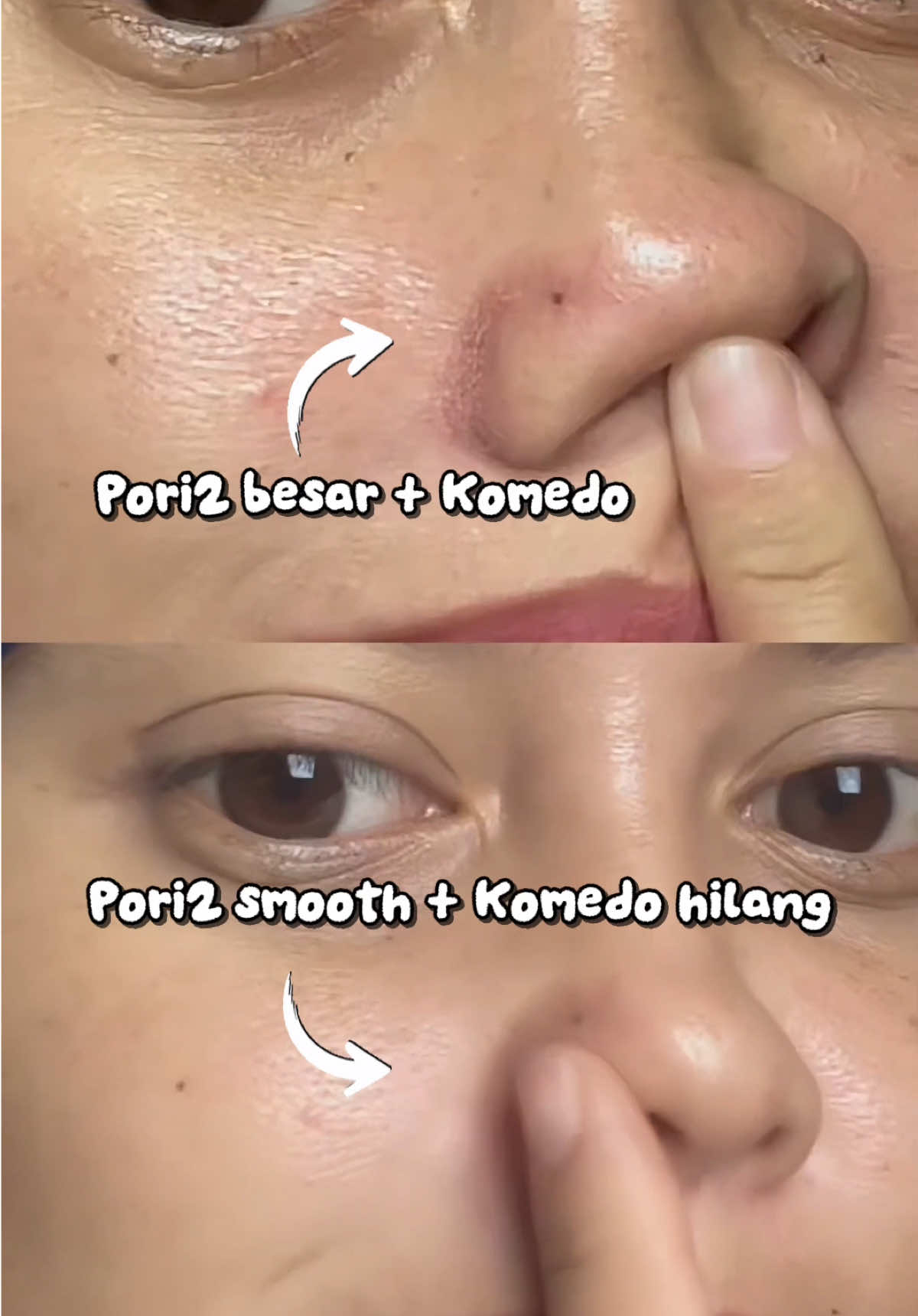 Ga perlu treatment mahal, cukup rajin pake produk ini 2x seminggu udah bikin wajah cerah, glowing, komedo rontok & pori2 mengecil 😍 #skincaremencerahkan #rekomendasiskincareremajabertekstur #produkviral #rekomendasiskincare #eksfoliasi 