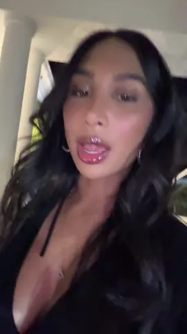 And at 3 weeks post op too 😌 shoutout to my surgeon @Rhinoplasty Türkiye 