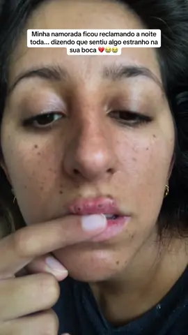 😭 #namorados #casal #hospital #mulher 