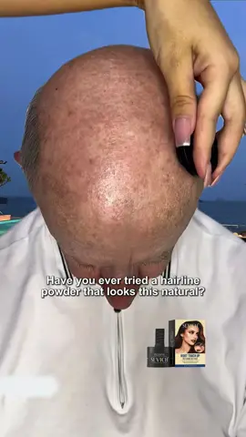 They tried our hairline powder and couldn’t believe the results. So natural, you’d never guess it’s makeup.#boldifystylingpowder #boldifyhairfibers #boldifyhairlinepowderb #hair #privatelabel 
