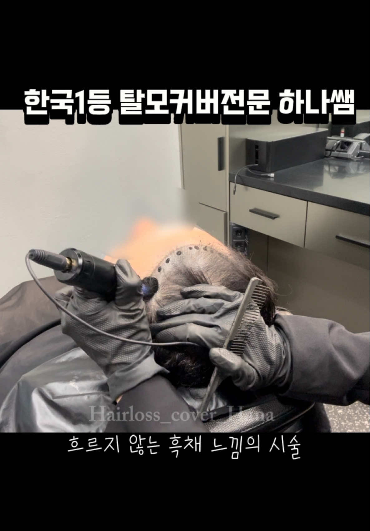 흐르지 않는 흑채란?  안녕하세요 한국 1등 탈모커버전문 하나쌤 입니다!  . 두피페인팅은 매번 흑채를 사용하시던 분들, 두피가 하얗게 보여 더 비어보이셨던 분들께  추천드리는 시술입니다! 흐르지 않고 물에도 지워지지 않는  흑채느낌의 시술입니다  흑채를 흩뿌린듯한 하나쌤의 ’스노우기법‘ 으로  자연스럽게! 밝은 조명에서 봐도  뭘 했는지 모르게! 커버 해드릴게요🥰 요새 정말 많은 고객님들께서  멀리서까지 찾아와주시는데요! 항상 방문 해주시는 고객님들  정말 감사합니다🥹 한분한분 꼼꼼히 진행 해드리기 때문에  조금씩 대기가 생길 수 있는데  기다려 주시는 고객님들께도 항상 감사드려요😭 모든 분들 최선을 다해서 커버 해드릴게요! 또, 하나쌤의 증모 모질이 정말 좋다는 피드백들을  받고 있어서 기쁜 하루하루 입니다!  모질이 좋을수록 매듭이 미세하고,  드라이를 해도 더 자연스럽답니다💕 저를 찾아와 주시는 고객님들껜  최고의 것들만 최상의 것들만 해드릴게요❤️ 우리 고객님들은 소중하니깐요! 시술에 대해 궁금하신 분들은  디엠/ 프로필 오픈채팅 링크로 문의주세요! What is a non-runny hair shadow? Hi, this is Hana, Korea’s No.1 Hair Loss Coverage Specialist! 🇰🇷✨ . Scalp painting is highly recommended for those who’ve been using hair shadows every day, or for those whose scalp looks white and makes thinning areas more noticeable. This treatment gives a non-runny, water-resistant hair-shadow effect that won’t wash off even with water. With Hana’s unique “Snow Technique”, I create a soft, scattered finish just like natural hair shadow— so natural that even under bright lights, no one will notice you’ve had anything done 🥰 Recently, many clients have been visiting from far away, and I’m so grateful for every one of you 🥹 Since I work carefully and thoroughly on each person, there might be a short waiting time, but I deeply appreciate everyone’s patience and trust 😭 I promise to give my best to every single client! 💪 Also, I’ve been receiving great feedback about my Hair Strand Extensions, especially about the amazing hair texture! The better the texture, the finer the knots— which means it looks more natural, even after blow-drying 💕 For everyone who visits me, I’ll always use only the best quality and techniques, because my clients deserve the best ❤️ If you have any questions about the treatment, please send me a DM or click the open chat link in my profile! 💌 . #두피페인팅 #scalppainting #증모술 #증모술교육 #hairextensions 