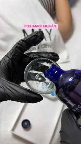 Công dụng peel image cho da dầu mụn #mayspa #peel_image #peel_mụn_ẩn #tip_trị_mun #trị_mụn_chuẩn_y_khoa 