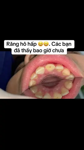 Tim đập theo nhịp ❌ Răng thở theo nhịp ✅ Sáng ra nha khoa gặp được case khách 16 tuổi mà cả phòng khám ngạc nhiên #xuhuongtiktok #chuatuy 