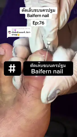 ตอบกลับ @보아 사랑 방탄 💜 พี่เขาเป็นอีกข้างให้แล้วนะคะ 😅  #ตัดเล็บขบนครปฐม #ร้านตัดเล็บขบนครปฐม #เล็บขบ #nails #ตัดเล็บขบ 