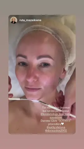 #DermaSkin #odosprieziuravilnius #retinolskincare #veidopilingas #oda 
