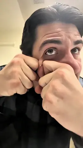 Avocado 🟰 base in the mask#Hero of fighting acne#Stable avocado