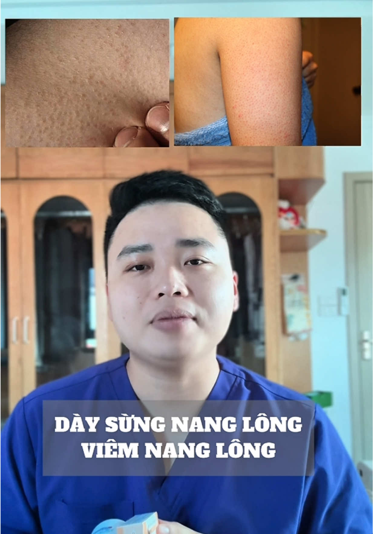 Viêm nang lông dày sừng nang lông #drtrangiakhanh #zahanclinic #viêmnanglông #daysungnanglong 