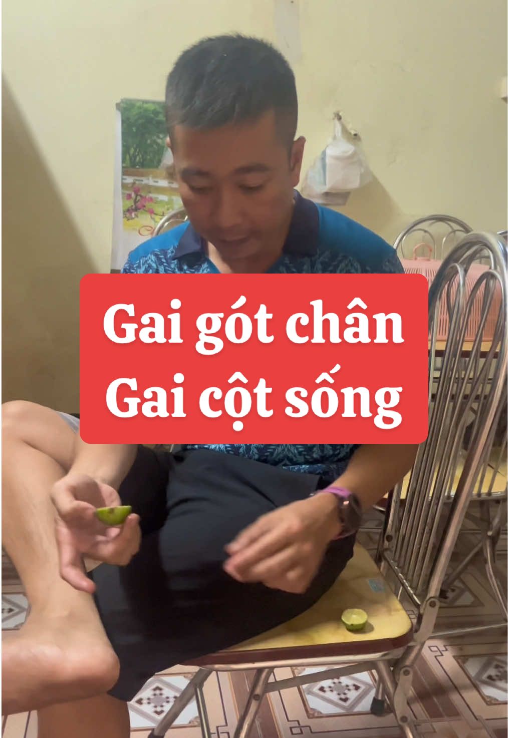 Gai gót chân hoặc cột sống lấy chanh chua khế chua nướng chín xoa vào vị trí gai này 2-3 lần mỗi lần 20p 
