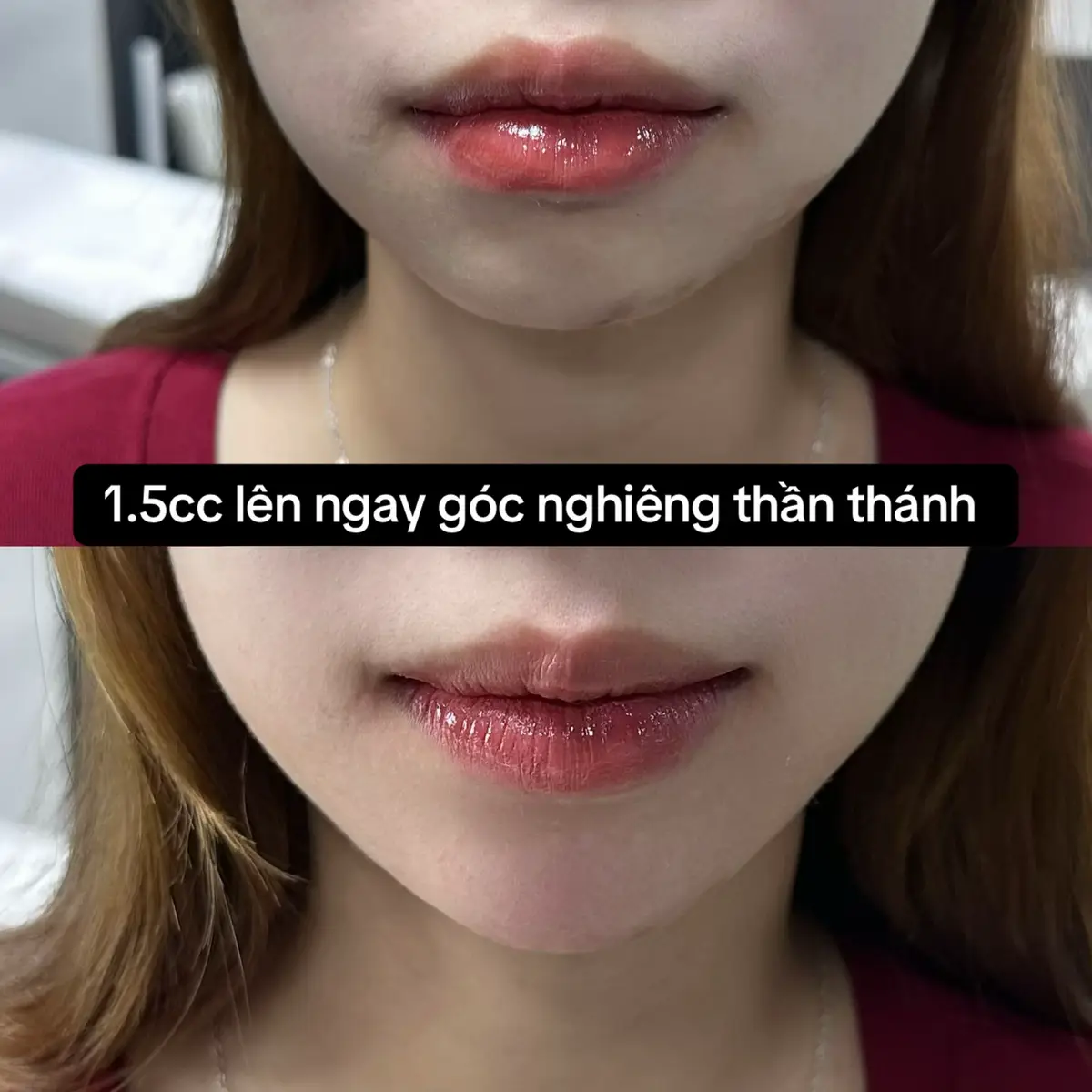 #meiliybeauty #xuhuong #tiemcam #gocnghiengthanthanh #tiktokviral 