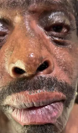 R.I.P. D’Angelo! 💯😇🪽 Filmed and Directed by   @Felice Tamara J #comedianharvdent  #harvdent  #reels  #shorts  #foryou    