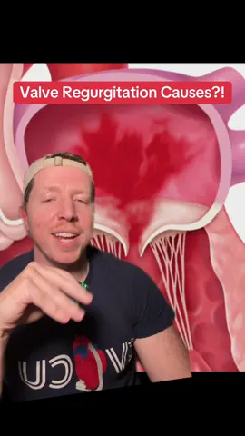 Valve Regurgitation: What can cause it?? . Check out the ICU STARTER BUNDLE and the other Nurse Dose Cheat Sheets/Resources in the bio! . Follow for more ICU nursing education! 🎓 . #cvicu #cardiacnurse #criticalcare #nursingschool #icunurse