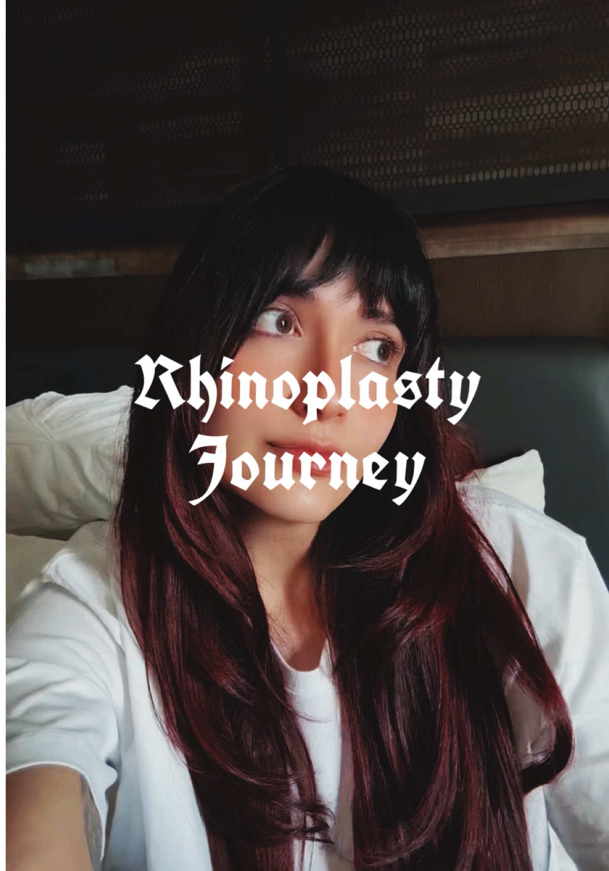 I did it! 🥰 Rhinoplasty Surgery 👃 #rhinoplasty #nosejob #rinoplastia #plasticsurgery #rhinoplastyjourney 