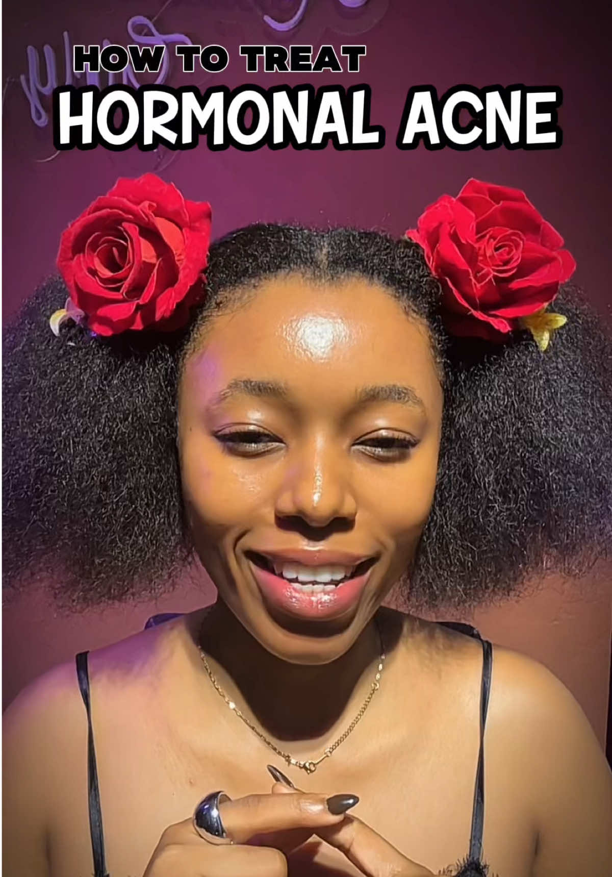 HORMONAL ACNE; Tips on how to treat Hormonal Acne effectively. #hormonalacne #hormonalimbalance #acne #skincare #acnetreatment 
