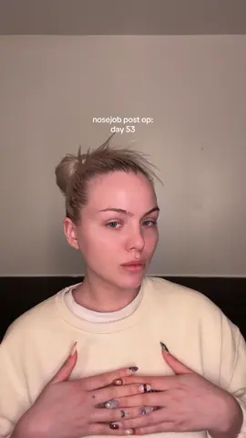 🥹🥹 nosejob post op: day 53 #nosejob #rhinoplasty 