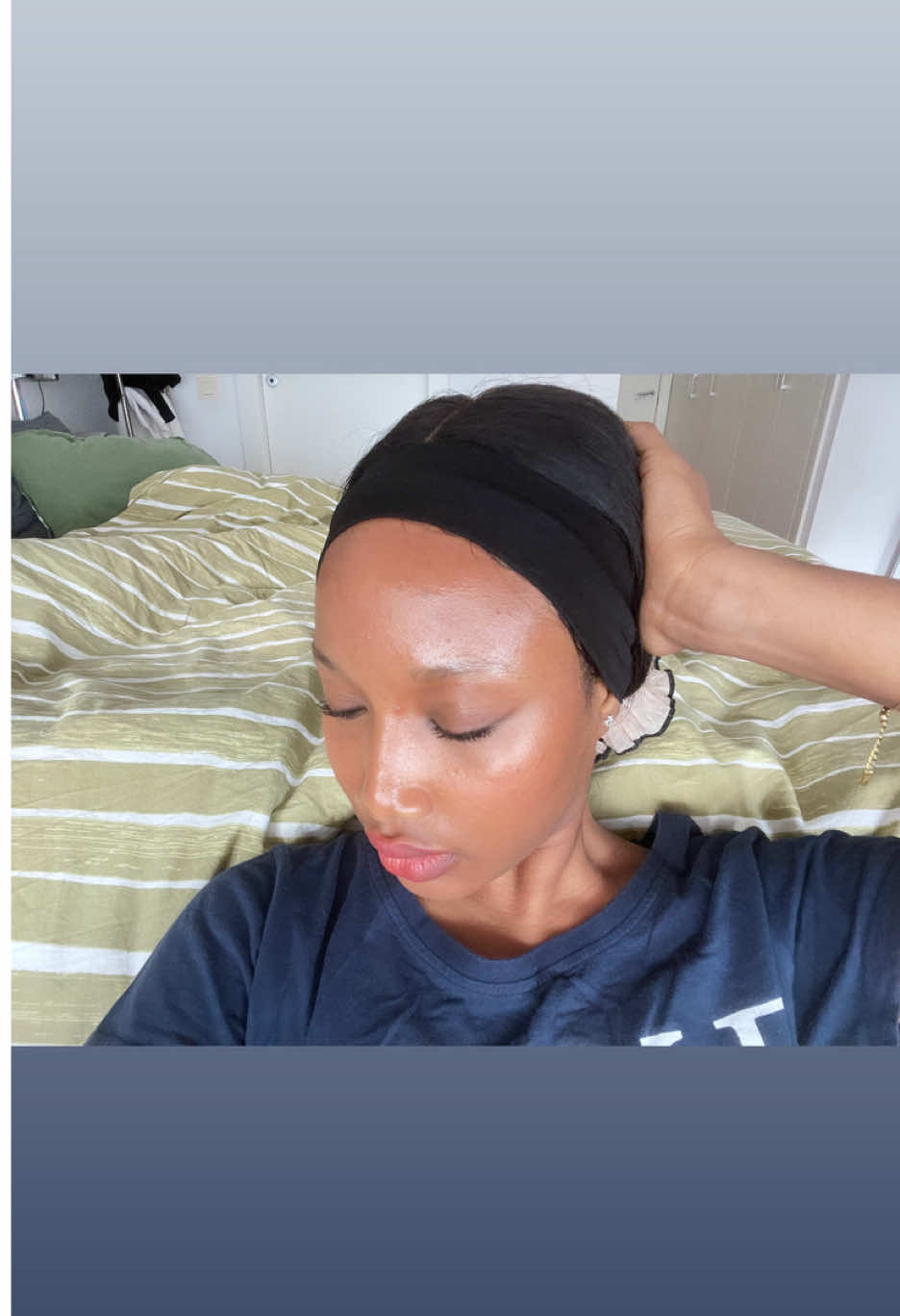 Welcome to my page✨🧖‍♀️                  #skincareconsistency #clearskinjourney #skintransformation #skincarecontent #acnesolutions 