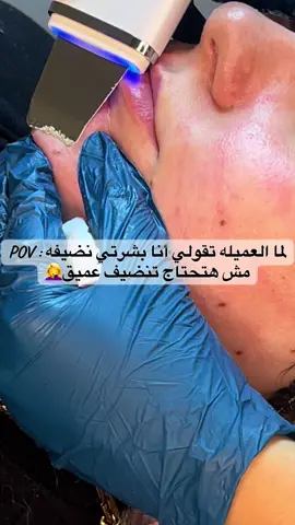 لما العميله تقولي أنا بشرتي نضيفه مش محتاجه تنضيف عميق 🤦‍♀️💔#تنضيف_بشرة #ديرمابلانينج #اكسبلورexplore #ميكروبليدينج #اكسبلور_تيك_توك 