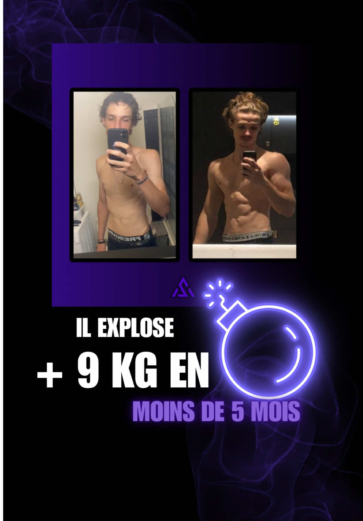 Hugo a littéralement explosé physiquement avec prêt de 9kg de muscles en 5 mois et des performances sur le squat, les dips, les tractions, et il a même explosé sur le muscle-up en passant du poids du corps à 3x10kg. Comme l’a dit Hugo il était très skinny au début de notre coaching, il n’aurait jamais pensé pouvoir se développer autant physiquement, mentalement ou encore au niveau de ses performances. C’est exactement ça notre promesse avec la méthode BEMASSIVE : évoluer sur tous les aspects, que ce soit mental, physique et performance. 💪 Si toi aussi tu veux passer à l’action avec la méthode « BEMASSIVE » et en savoir plus, envoie-moi « GO »en DM ! 💪🏾🙂 #musculation #gym #Fitness #bulk #prisedemasse 