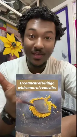 Home made vitiligo treatment #jspbeautyandfation2 #jspbeautyandfation 