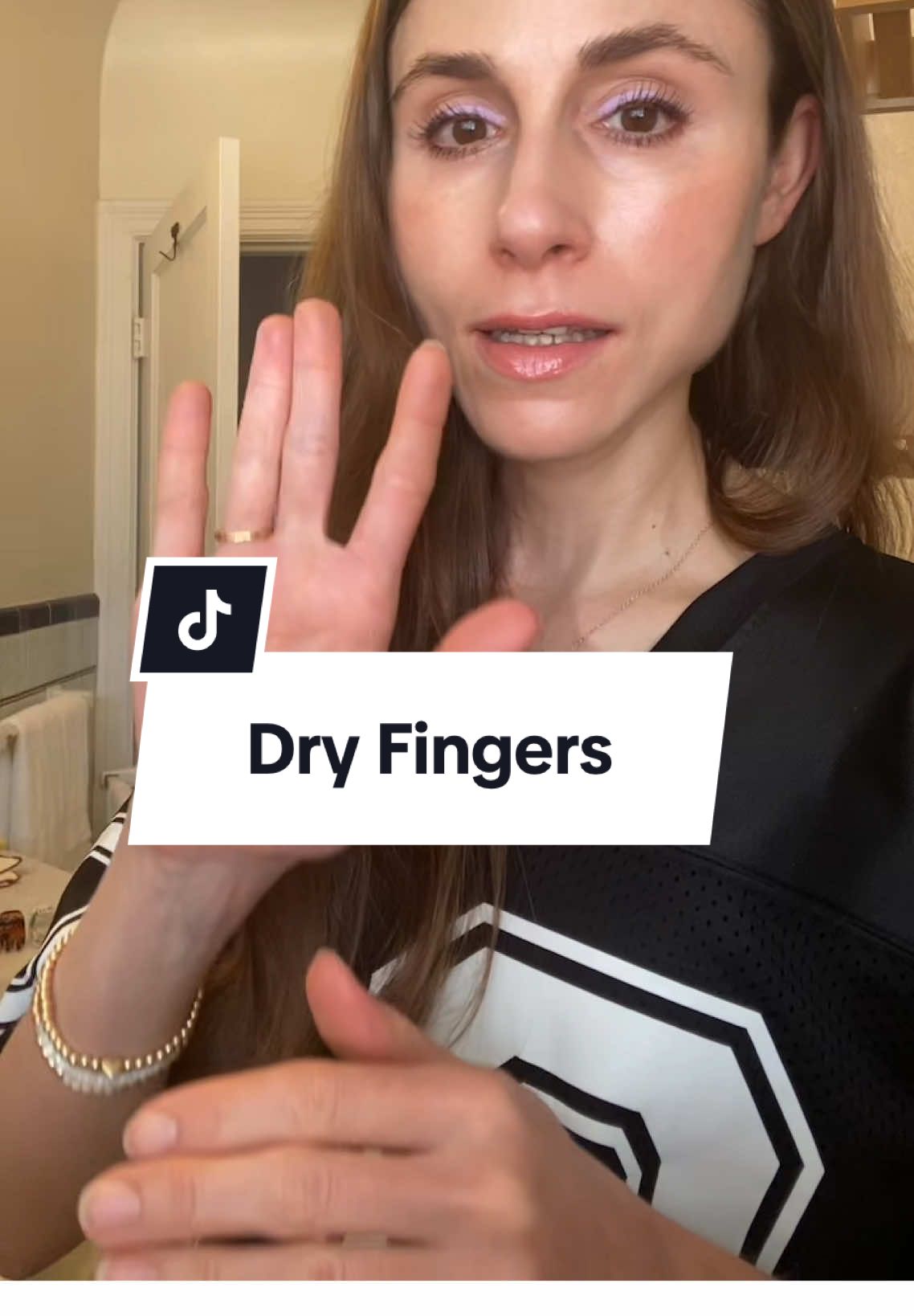 Dry, cracked fingers? Pro-tip! Take your rings off when you wash your hands. #dryskin #dryskintips #dryskincare #dermatology #creatorsearchinsights 